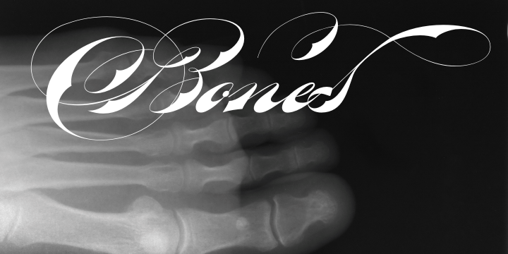 Bradstone-Parker Script