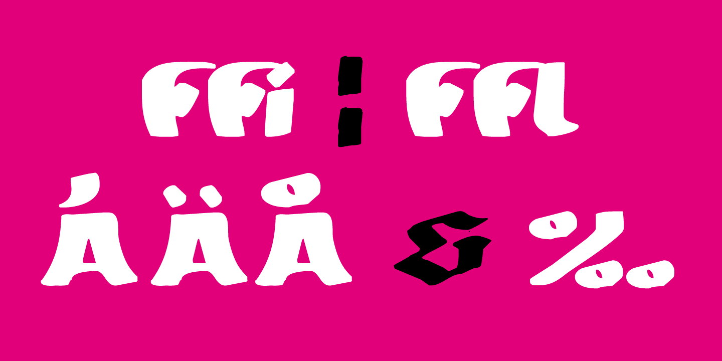 MODERN Hand Fraktur